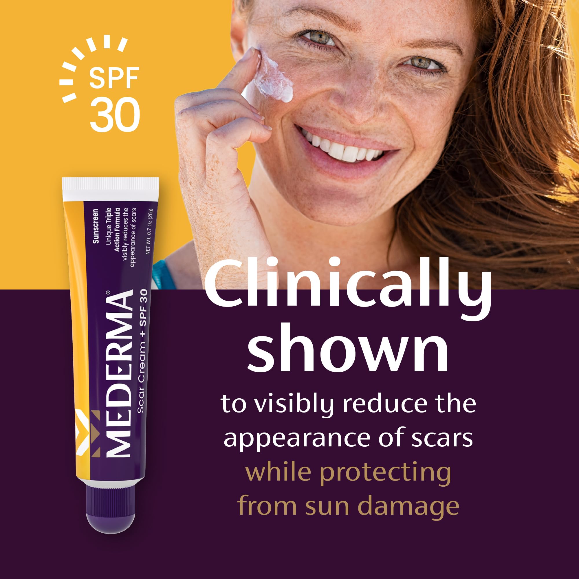Mederma Scar Cream Plus SPF 30 - Advanced Scar Treatment, Protects from Sun Damage, Reduces Appearance of Scars from Acne, Burns, Surgery & Injury, 0.7 oz