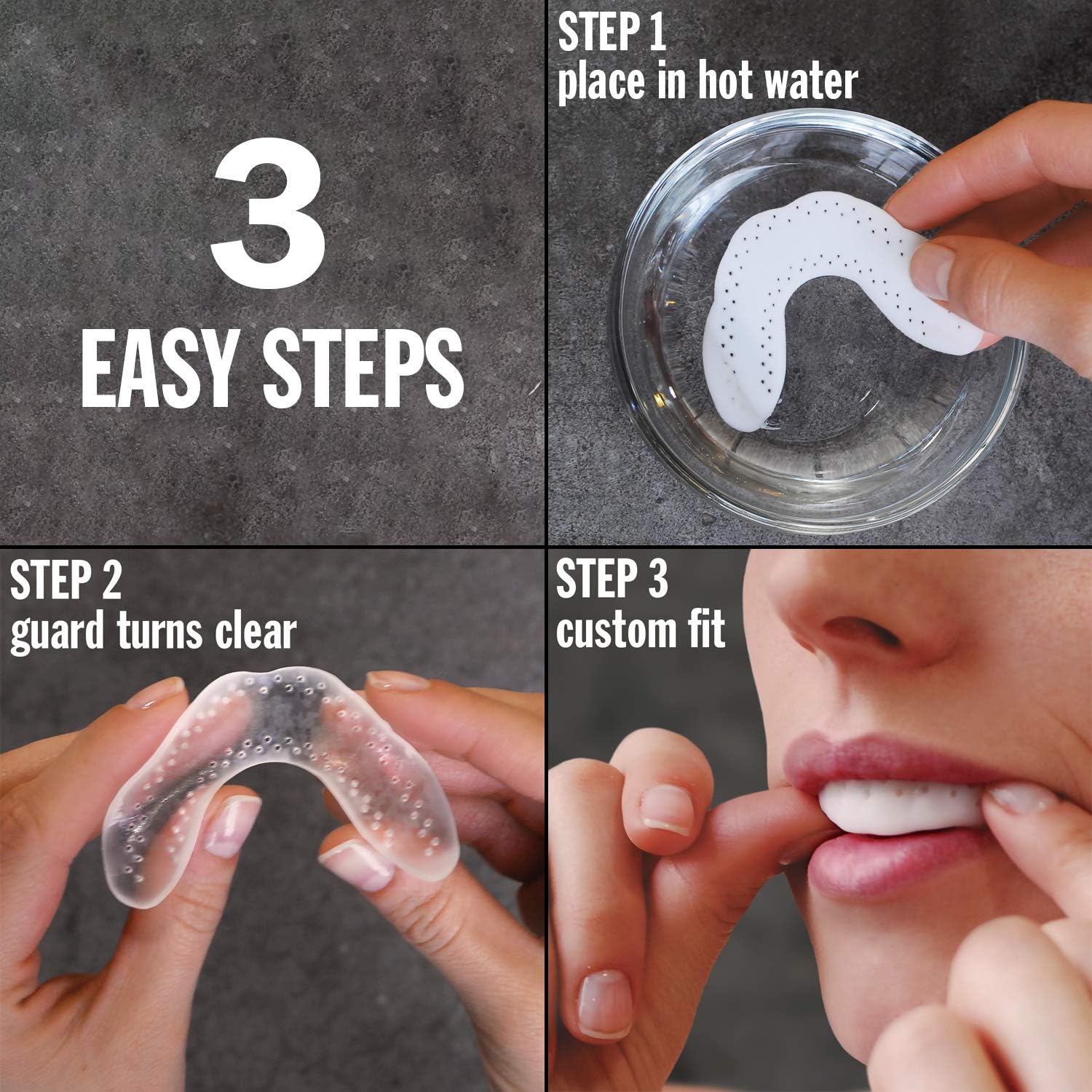 LunaGuard Nighttime Dental Guard – Comfortable Dental Protection for Teeth Grinding and Clenching Plus Storage Case: Health & Personal Care