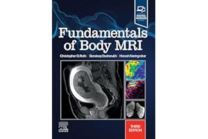 Fundamentals of Body MRI E-Book (Fundamentals of Radiology)