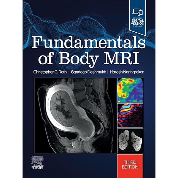 Amazon.com: Meyers' Dynamic Radiology of the Abdomen: Normal and