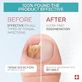 PODERM Pack Duo 2-in-1 Anti Fungal Nail Treatment Swiss-Made Serum & Booster view 3