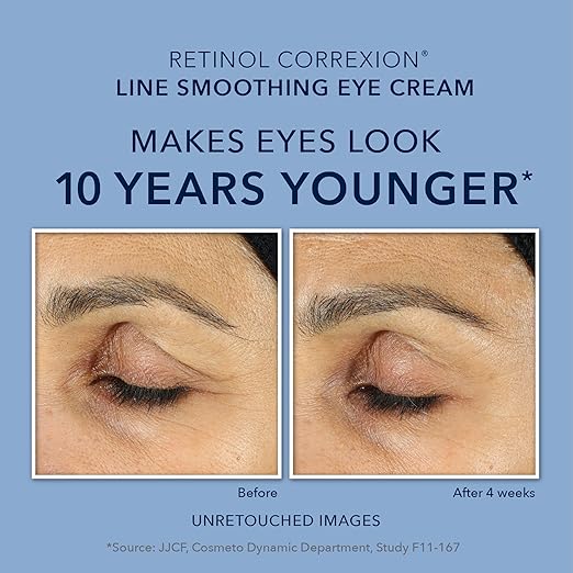 amazon roc eye cream