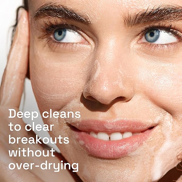 CETAPHIL ACNE FACE WASH, GENTLE CLEAR CLARIFYING ACNE CREAM CLEANSER WITH 2% SALICYLIC ACID, DEEP CLEANS & TREATS ACNE PRONE SKIN, SKIN CARE FOR SENSITIVE SKIN, 4.2OZ