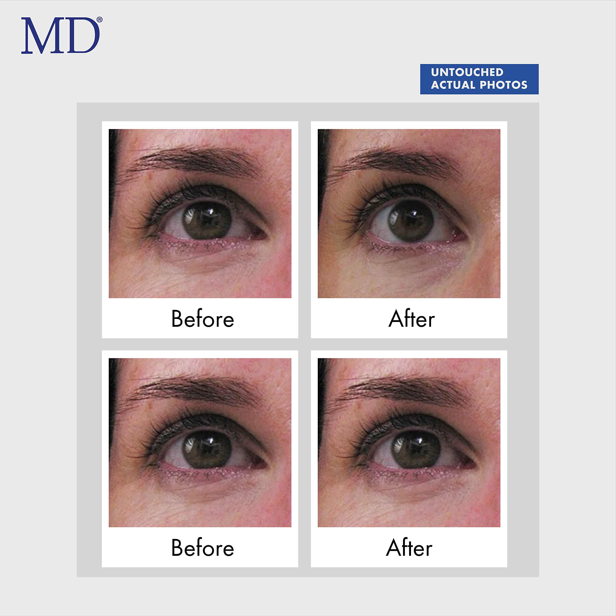 MD Lash Factor MD Ultimate Eye Cream – Under Eye Cream for Reduced Dark Circles, Puffiness, Wrinkles, Bags & Anti-Aging – Enriched with Collagen, Peptides, Shea Butter for Firmness, Lifting & Moisturization