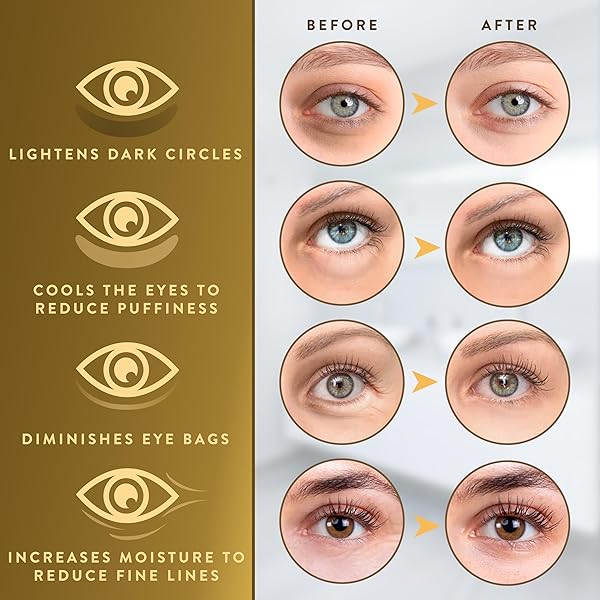 LIVE WILD BEAUTY UNDER EYE PATCHES (72 PATCHES) FOR PUFFY EYES AND DARK CIRCLES WITH PURE COLLAGEN, 24K GOLD EYE GEL PAD MASKS FOR REDUCING EYE BAGS, PUFFY DARK CIRCLES, WRINKLES, AND FINE LINES