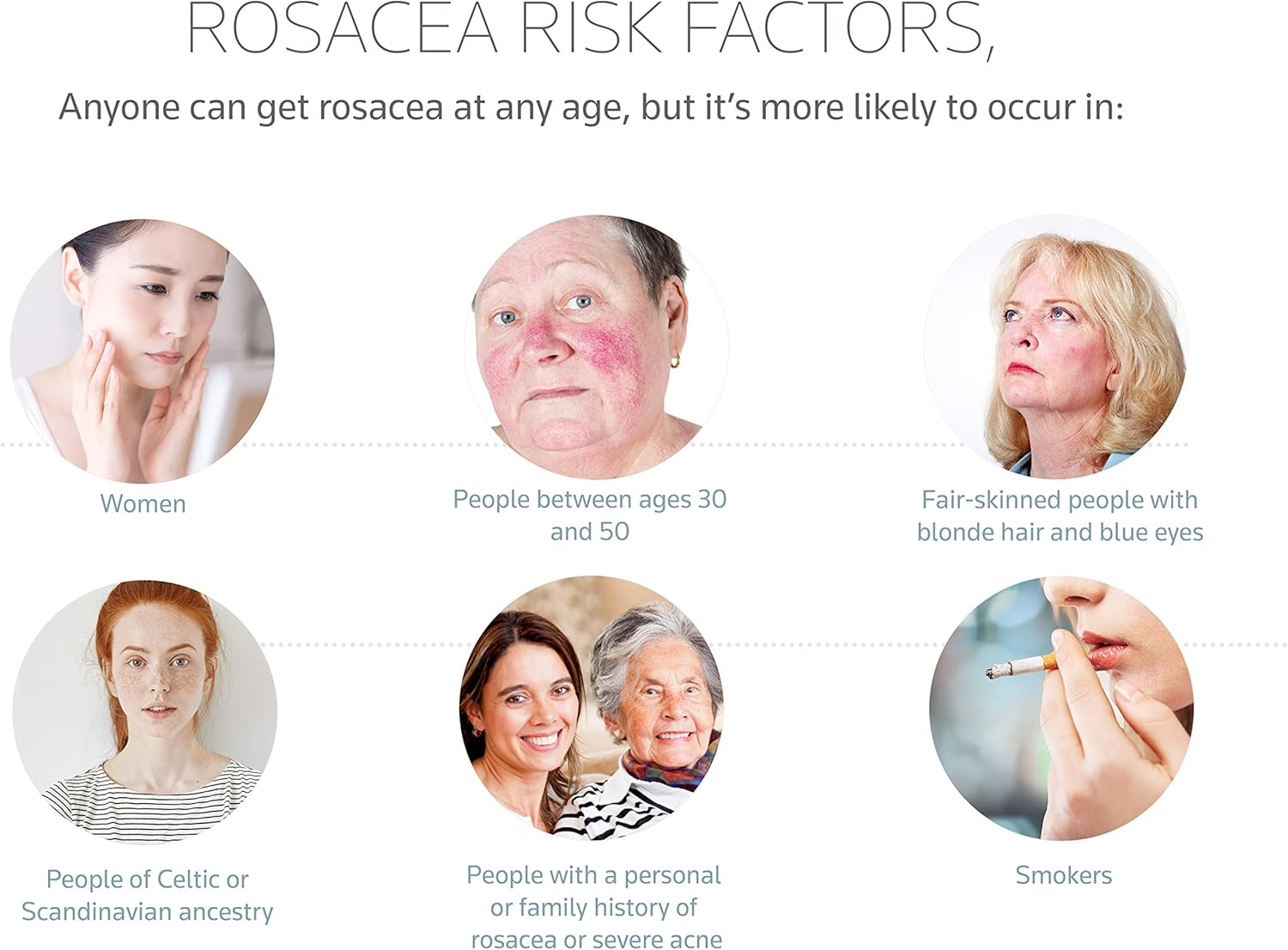 Prosacea – Controls Maskne Rosacea Symptoms of Redness, Pimples & Irritation – 0.75 Oz: Health & Personal Care