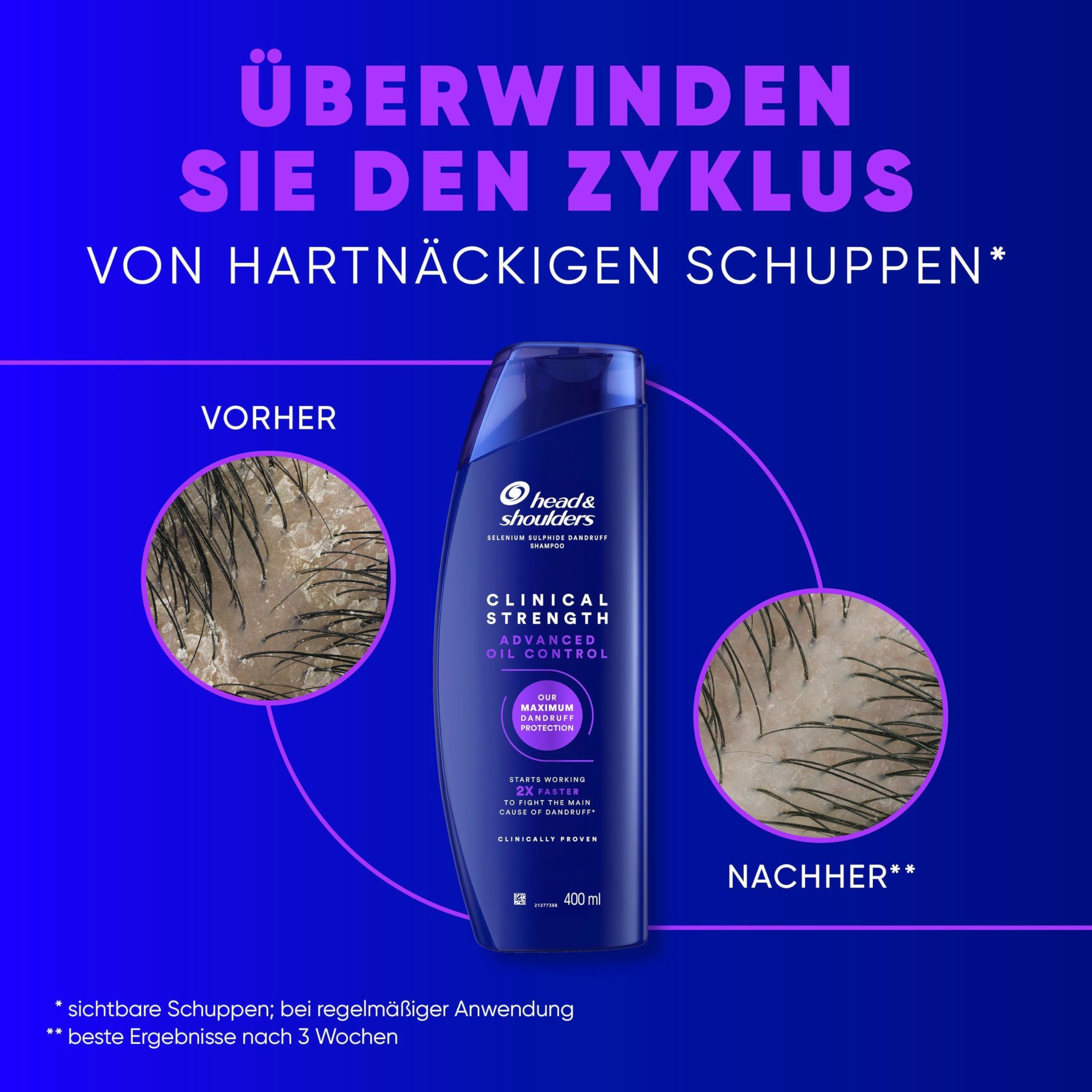 Head & Shoulders Advanced Oil Control Anti-Schuppen Shampoo mit Selensulfid 400ml, Clinical Strength, Bekämpft Hartnäckige Schuppen und Überschüssiges Öl mit Frischem Zitrusduft 3