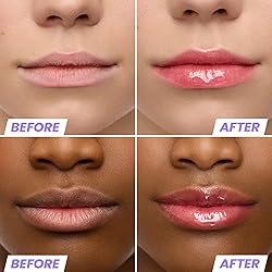 Wonderskin Lip Oil Rehab Serum - Tinted Lip Oil for