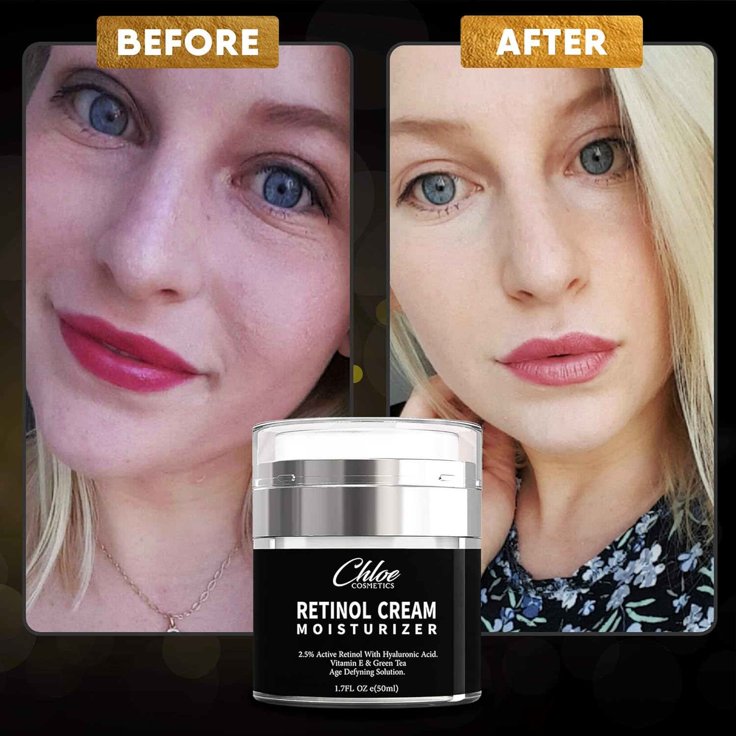 Retinol Moisturizer for Face and Eye area | Anti Aging Cream with Hyaluronic Acid, 2.5% Active Retinol and Vitamin E | Reduces Appearance of Wrinkles and Fine lines | Best Day and Night Face Cream: Beauty