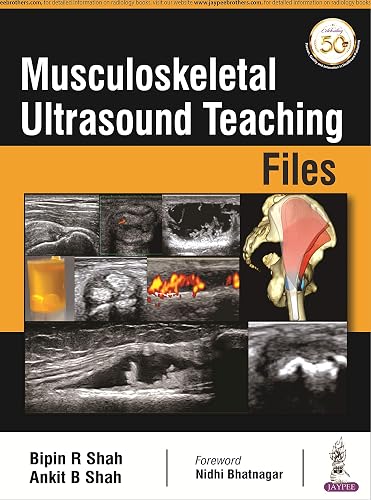 Download Musculoskeletal Ultrasound Teaching Files PDF