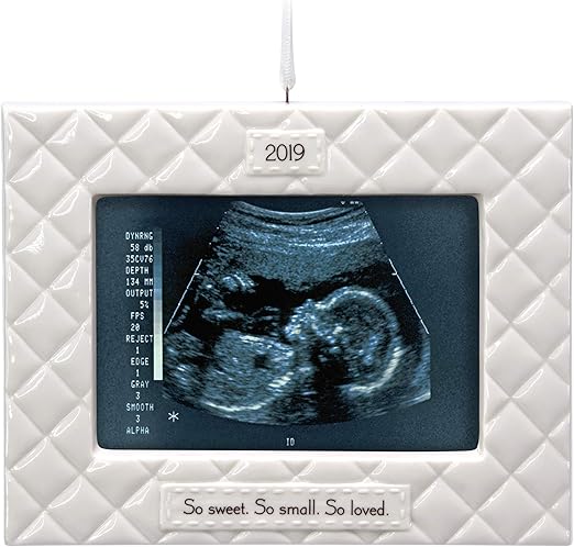 baby ultrasound ornament