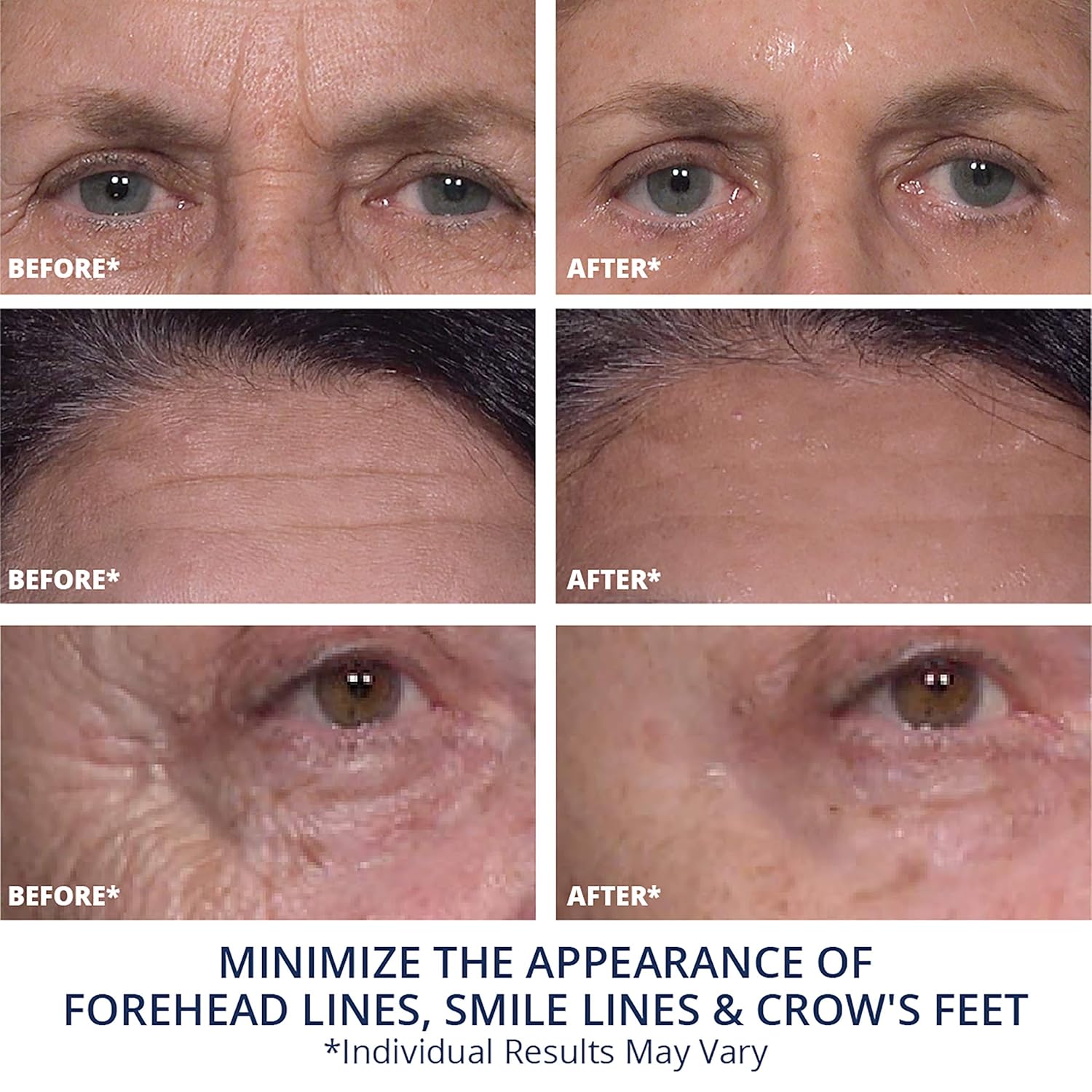 plexaderm rapid reduction serum