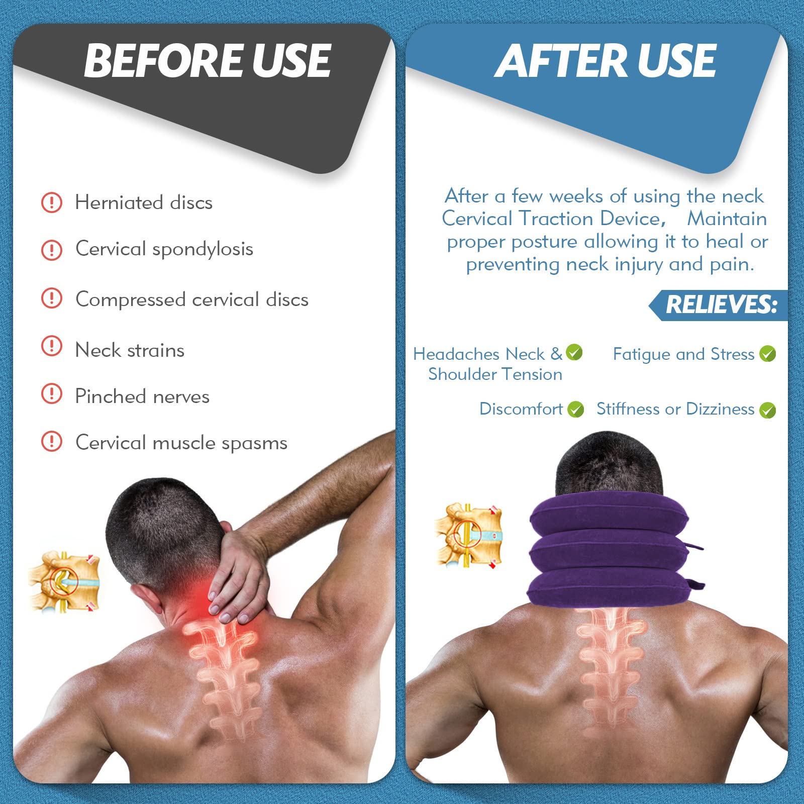 Jaximy Neck Stretcher, Cervical Traction Device, Neck Traction Device, Neck Pain Relief, Adjustable Inflatable Neck Brace & Neck Stretcher Cervical Traction, Neck Decompression Home Use (Purple)