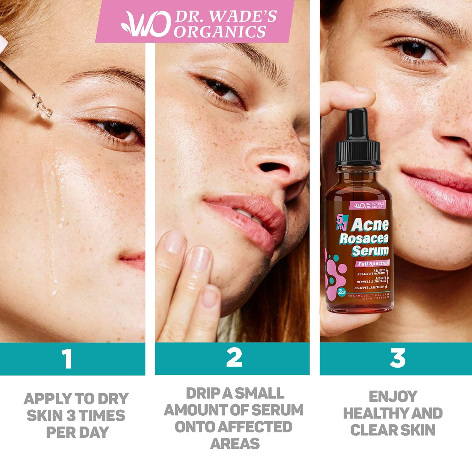 Acne Treatment Serum - Natural Skin Care Serum for Acne and Dark Spots with Niacinamide, Tea Tree Oil, Hyaluronic Acid & Tamanu Oil - Effective Rosacea Treatment - Acne Serum for Oily Skin: Beauty