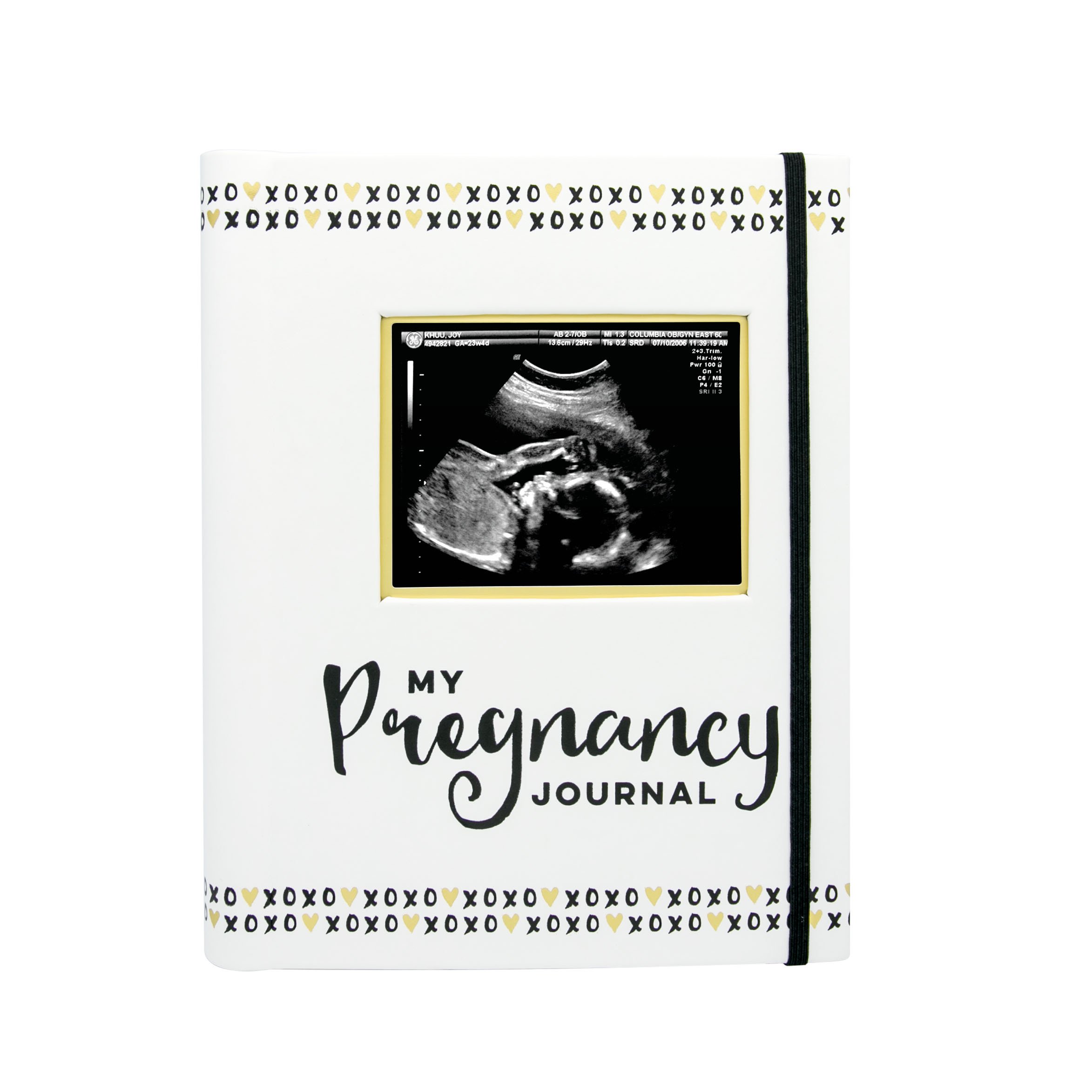 Pearhead My Pregnancy Journal, Pregnancy Keepsake Book, Pregnancy Milestone Memories and Photo Album, Gender Neutral for Baby Girl or Baby Boy