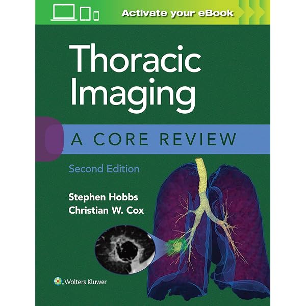 Thoracic Imaging: Case Review: 9780323428798: Medicine & Health