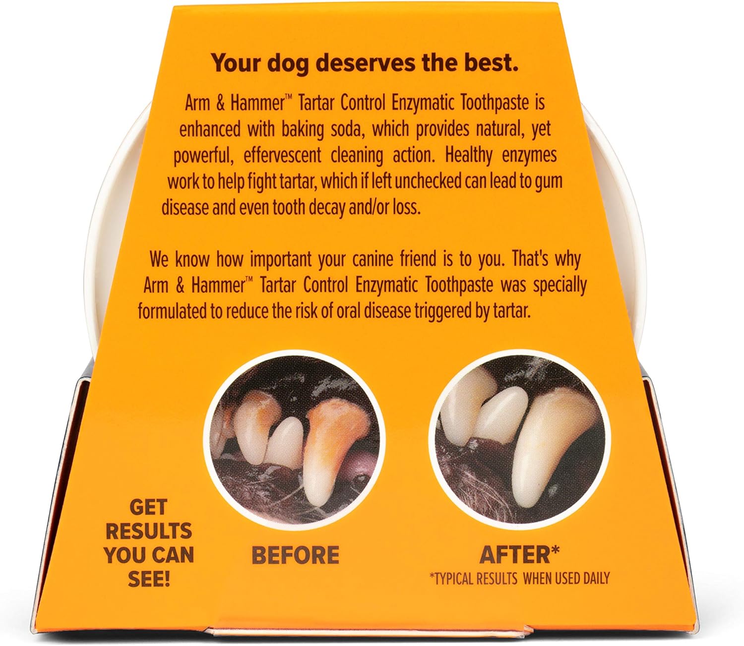 Arm & Hammer Dip & Brush Tartar Control Enzymatic Toothpaste Kit for