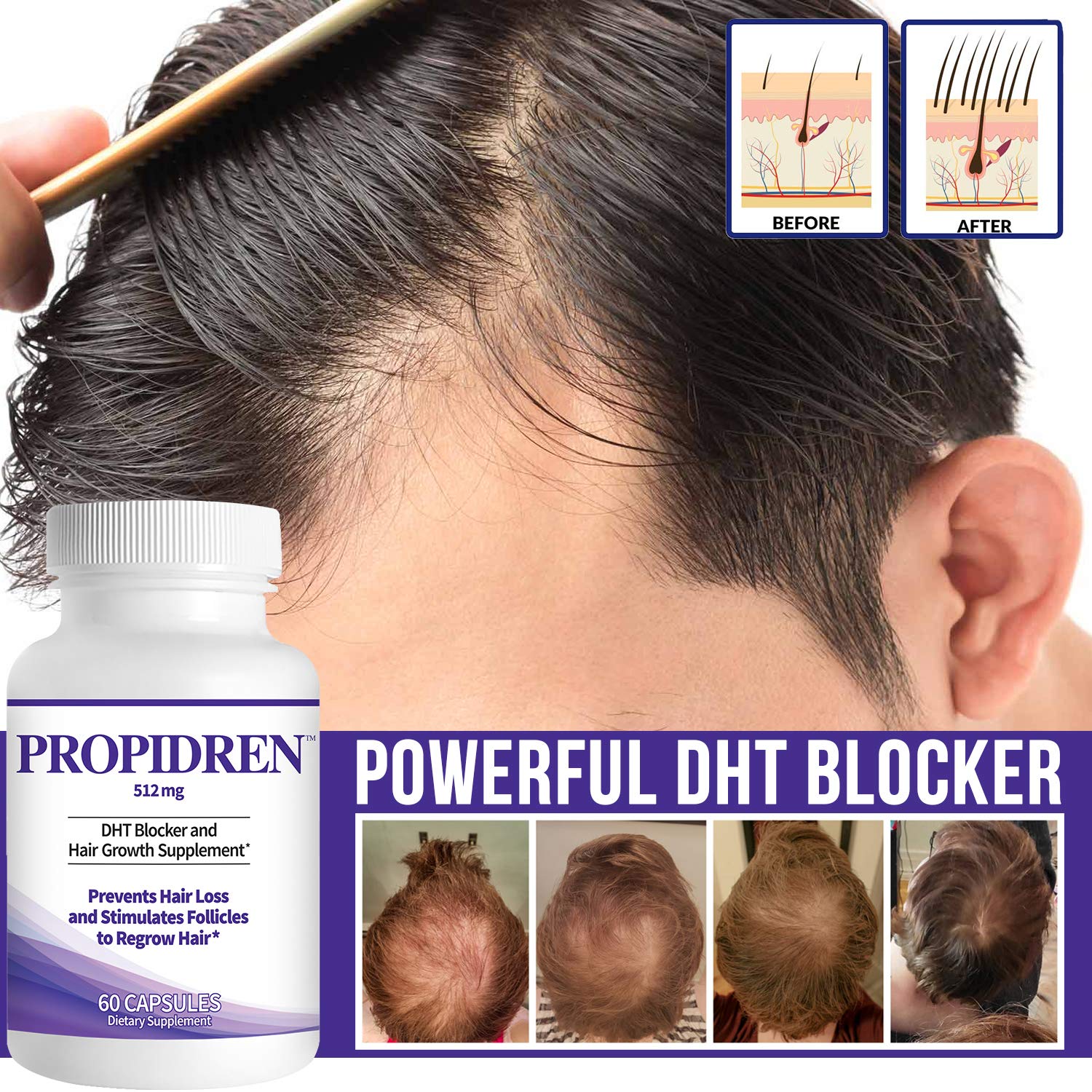 Propidren by HairGenics DHT Blocker & Hair Growth Capsules to Prevent