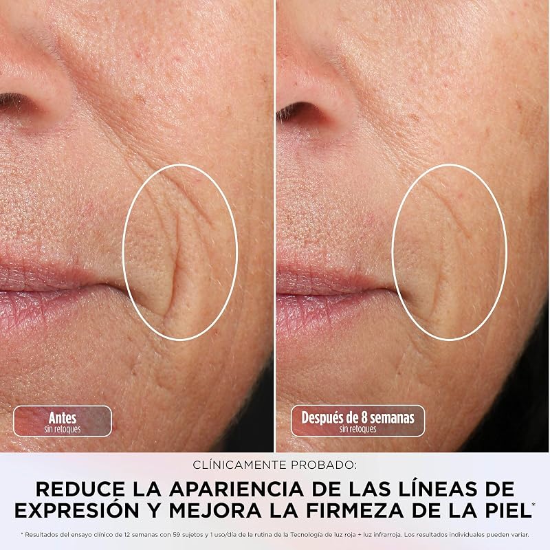CryoGlow, Máscara Facial LED Vermelha e Azul, Cor Azul