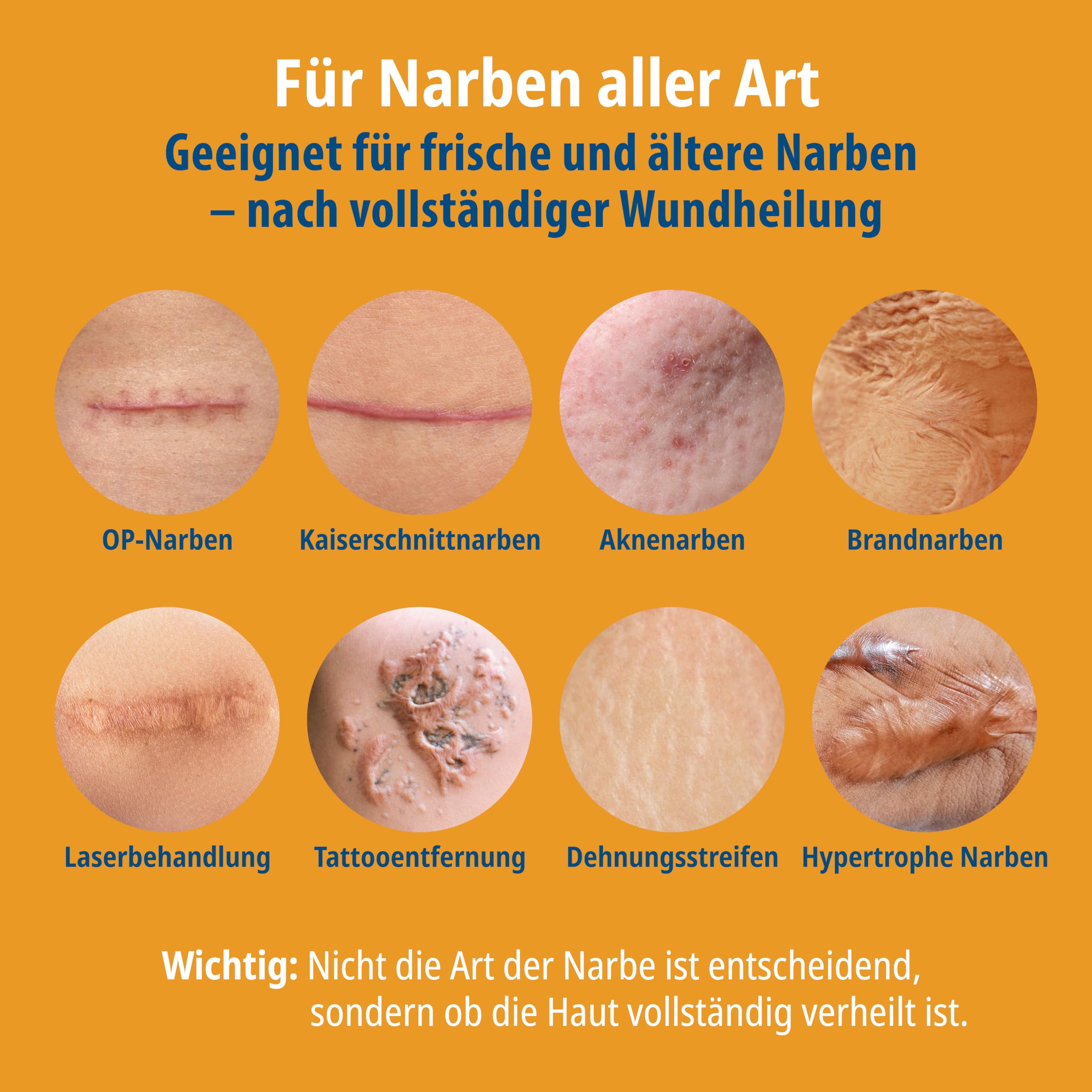 Evolsin® Narbengel für Kinder & Erwachsene, 20 g 4