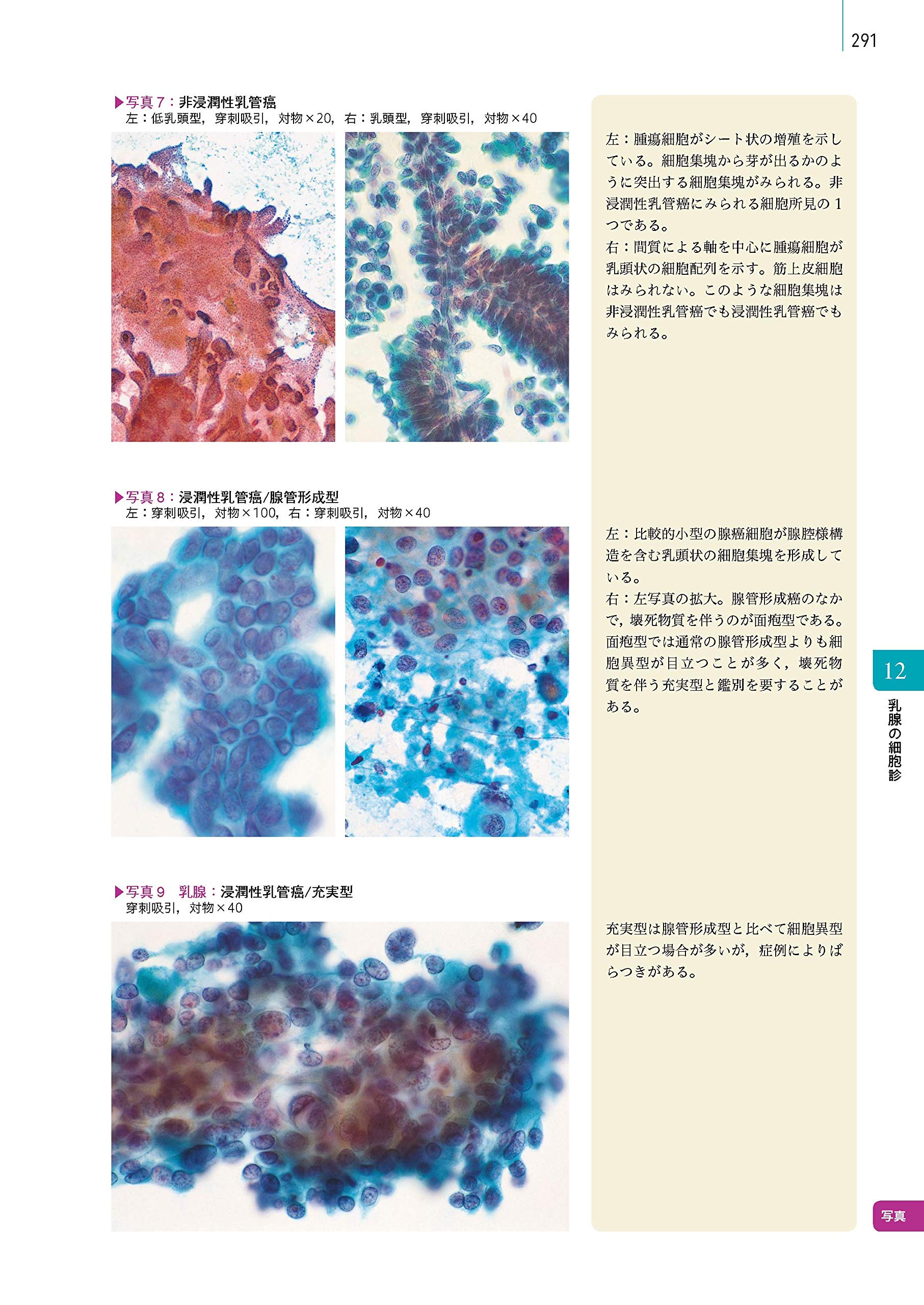 細胞診を学ぶ人のために 第6版 9784260037990 Amazon Com Books