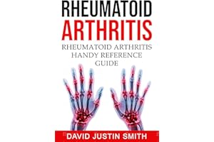 Rheumatoid Arthritis:Rheumatoid Arthritis Handy Reference Guide(Acute rheumatoid arthritis, alternative treatment for rheumat