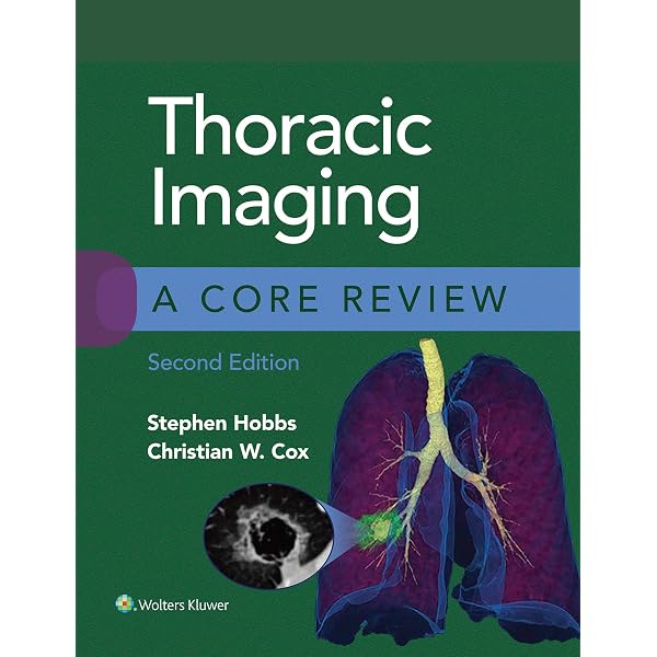 Amazon.com: Webb & Higgins Thoracic Imaging: eBook without
