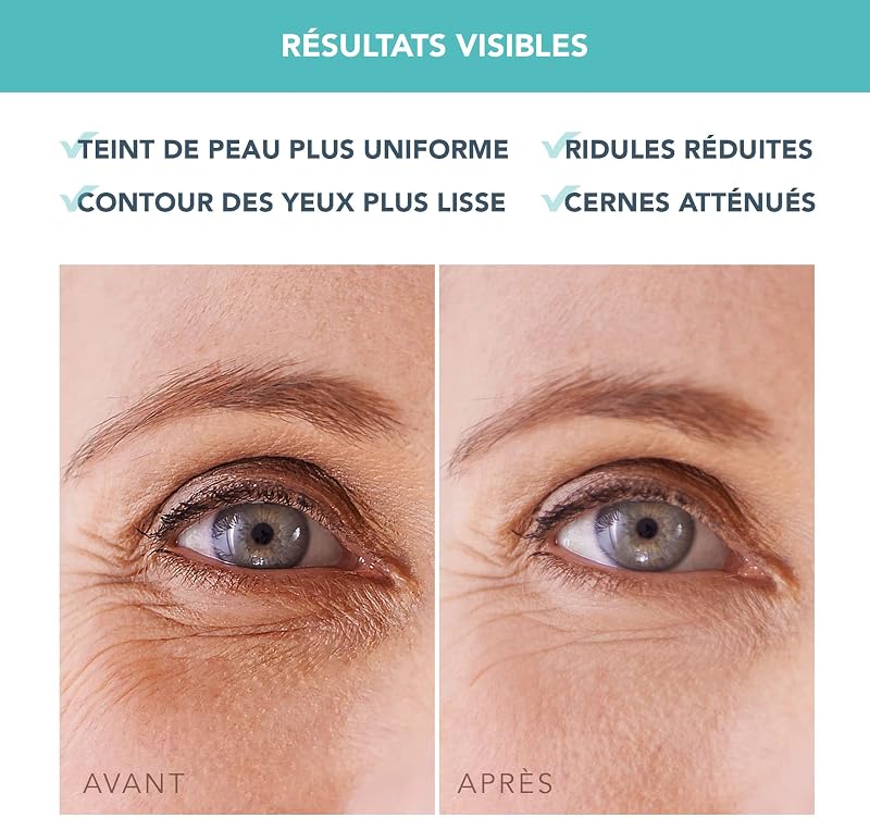 IRIS Patch Yeux Anti Cernes au Collagène et Rétinol- Anti Cernes Yeux Femmes et Hommes - Anti Poches sous les Yeux - Vtiamine E et Vitamine C - Patch Anti Rides Visage - Végan - 60 pc.