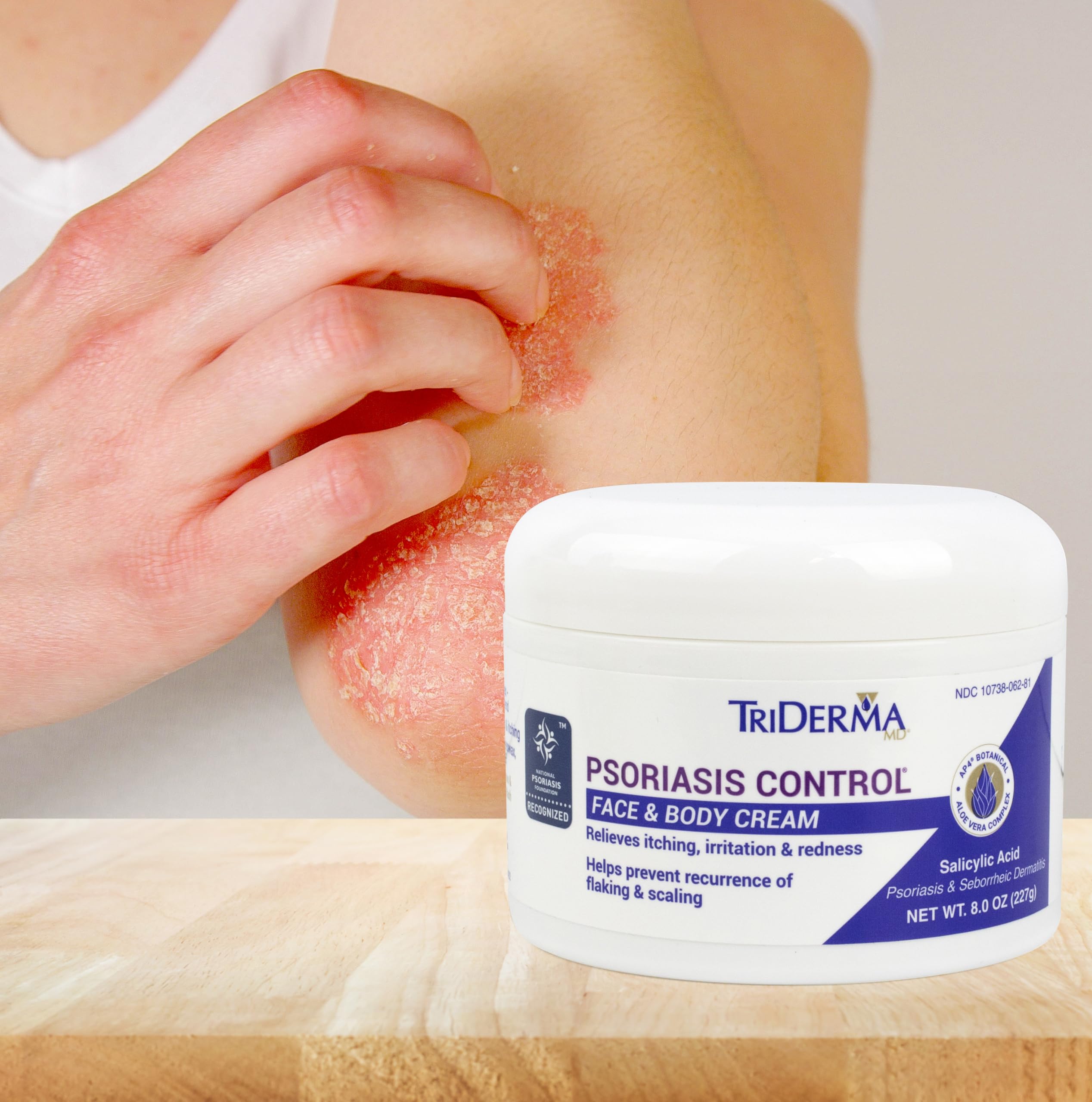TriDerma Psoriasis Control Face & Body Cream - Maximum Strength 3% Salicylic Acid - Moisturizing Psoriasis Cream (No Cortisone, Fragrance or Parabens) - 8 Oz Jar
