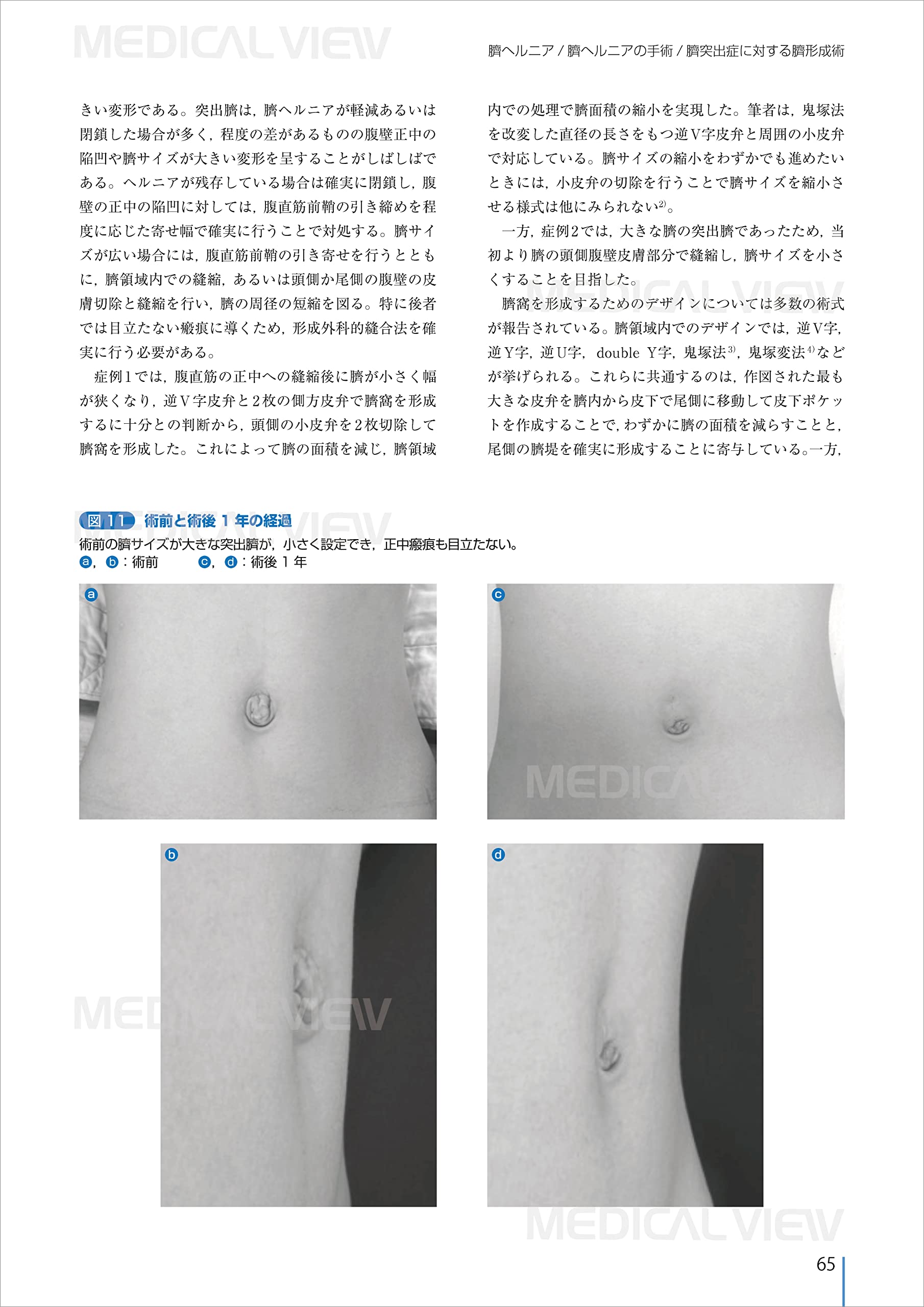 最安値挑戦 小児の臍疾患治療と臍を利用した手術 臍の外科 医学 薬学 Www Access00 Co Jp 最安値挑戦 小児の臍疾患治療と臍を利用した手術 臍の外科 医学 薬学 Www Access00 Co Jp