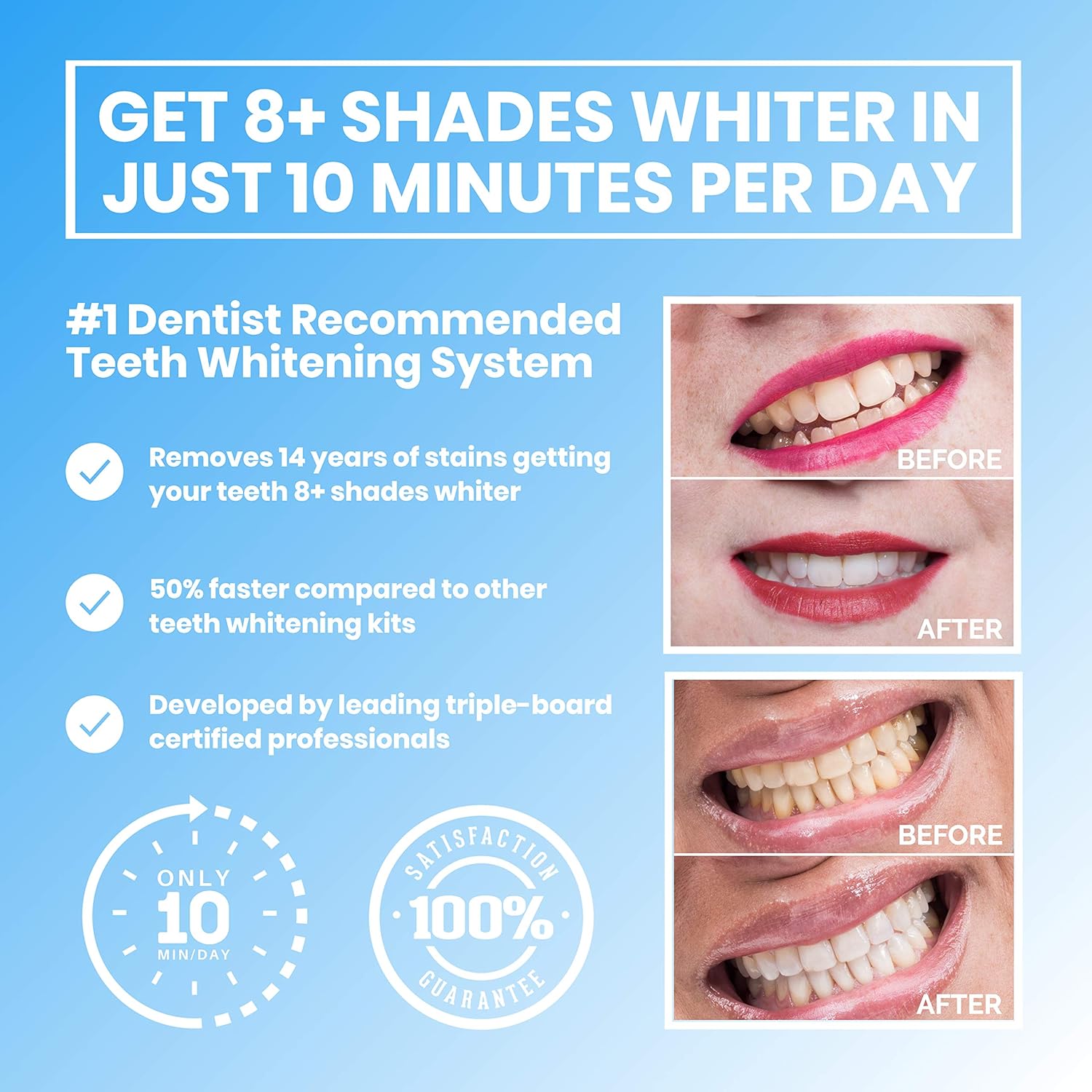 Niusmile Teeth Whitening System | #1 Dentist Recommended Activated Charcoal Teeth Whitening Kit | Teeth Whitening Kit with LED Light + Mouth Tray + Organic Coconut & Peppermint Teeth Whitening Gel: Beauty