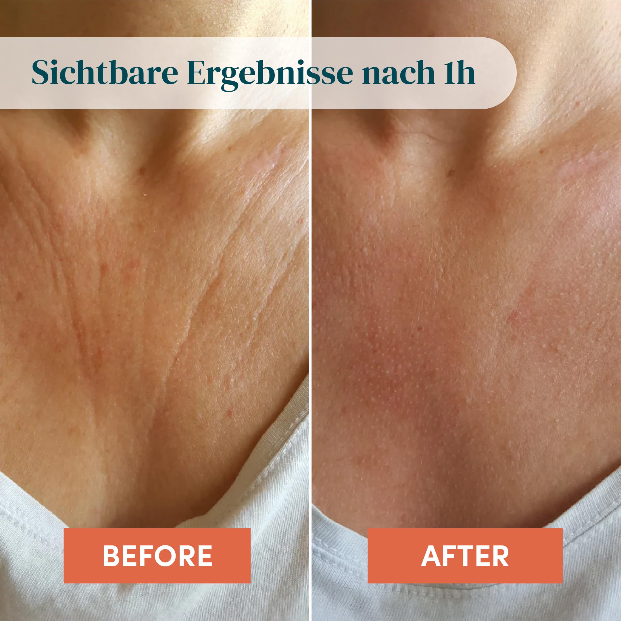 APRICOT Dekollete Pad Antifalten aus medizinischem Silikon mit niedermolekularem Hyaluron - Bis zu 30x Wiederverwendbar, Dermatologisch Bestätigt, Vegan & Tierversuchsfrei - Dekollete Anti Falten Pad 4