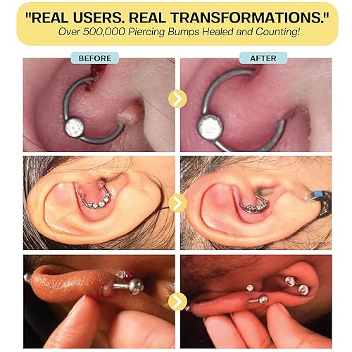 Scar Ear Piercing Wound Treatment Piercing Bump Relief,heal
