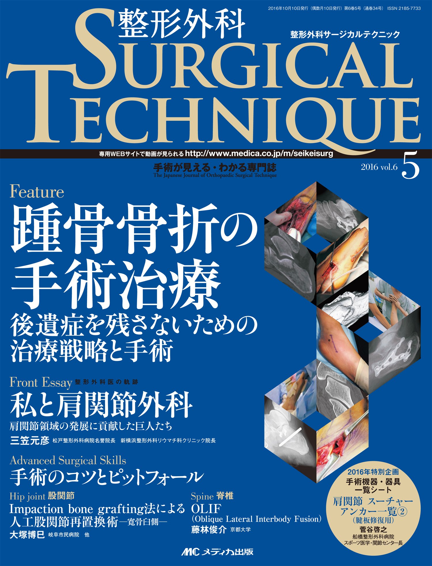 整形外科サージカルテクニック 16年5号 第6巻5号 特集 踵骨骨折の手術治療 後遺症を残さないための治療戦略と手術 本 通販 Amazon 整形外科サージカルテクニック 16年5号 第6巻5号 特集 踵骨骨折の手術治療 後遺症を残さないための治療戦略と手術 本 通販 Amazon