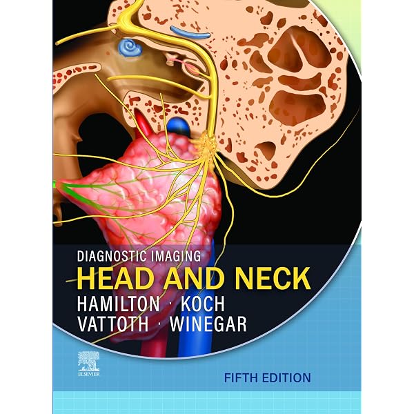 Amazon.com: Osborn's Brain E-Book eBook : Osborn MD, FACR, Anne G