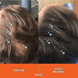 DS Laboratories Revita Shampoo - Hair Thickening