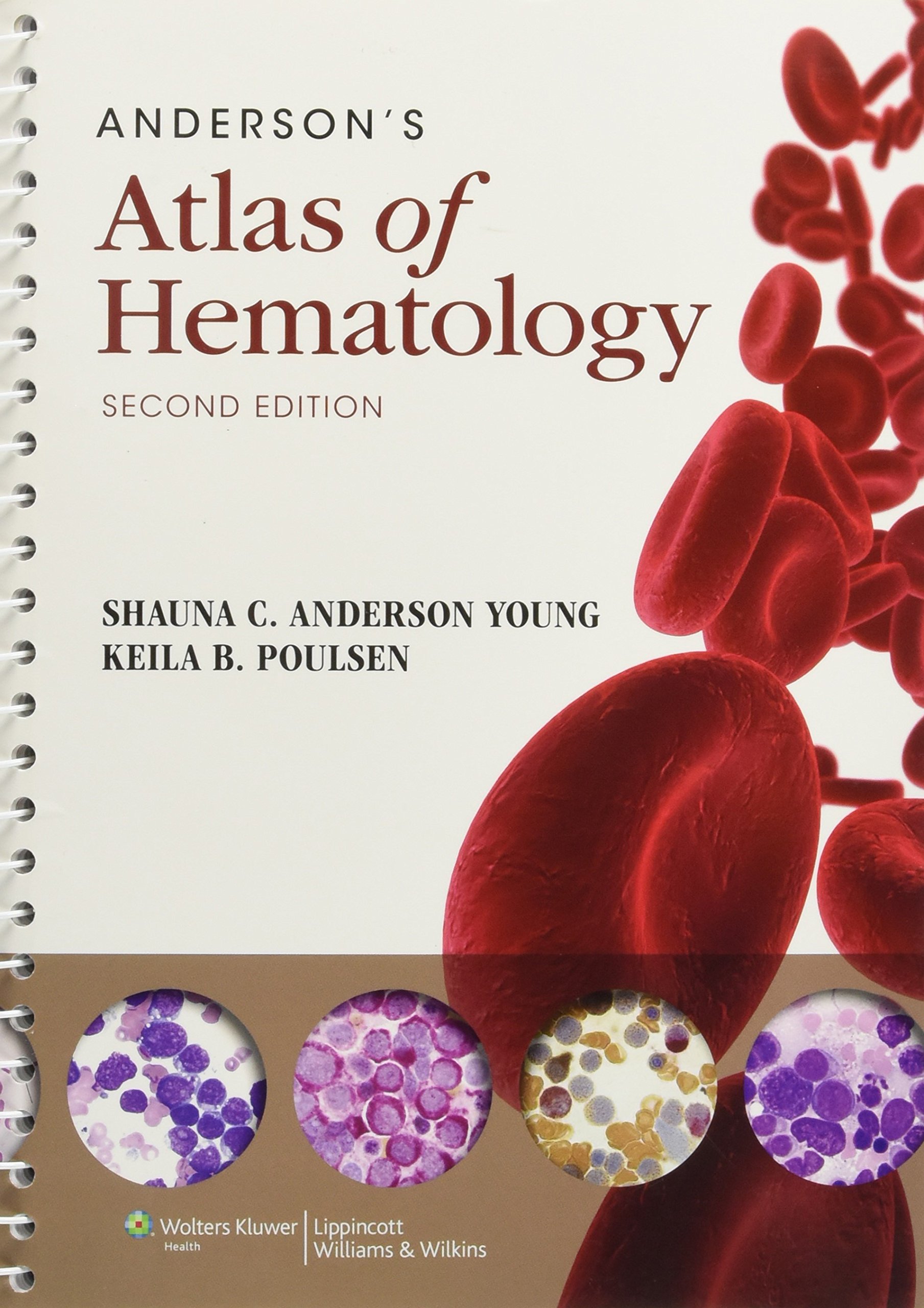 Anderson S Atlas Of Hematology Amazon Co Uk Shauna C Anderson Keila B Poulsen 9781451131505 Books