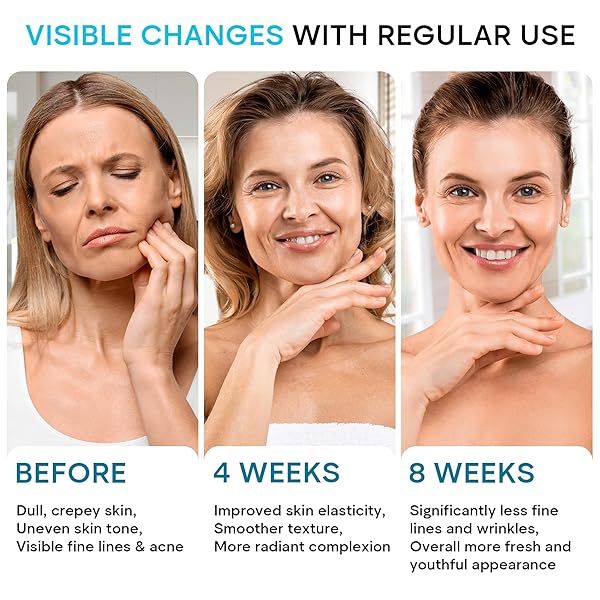 REMEDIAL PAX FACE MOISTURIZER RETINOL CREAM, ANTI AGING NECK FIRMING CREAM, COLLAGEN DAY & NIGHT FACE CREAM WITH HYALURONIC ACID FOR WOMEN & MEN, 1.85 FL OZ