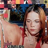 Sunburn