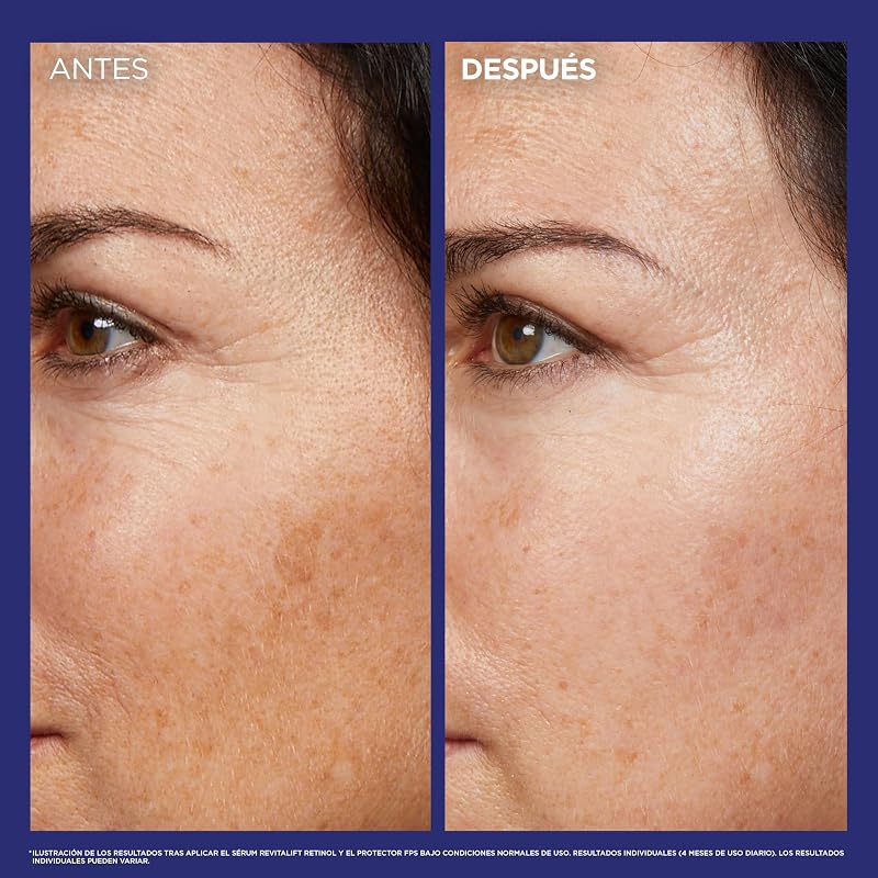 L'Oréal Paris Revitalift Laser Serúm de Noche Nº1 con Retinol Puro, 30ml
