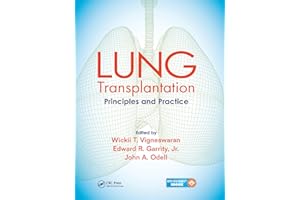 Lung Transplantation: Principles and Practice