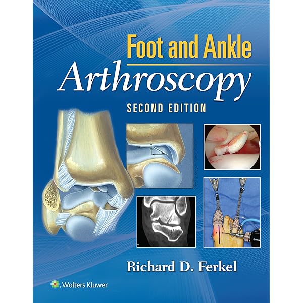 洋書 Sarrafian's Anatomy of the Foot & Ankle Sarrafian's Anatomy of the Foot and Ankle: Descriptive