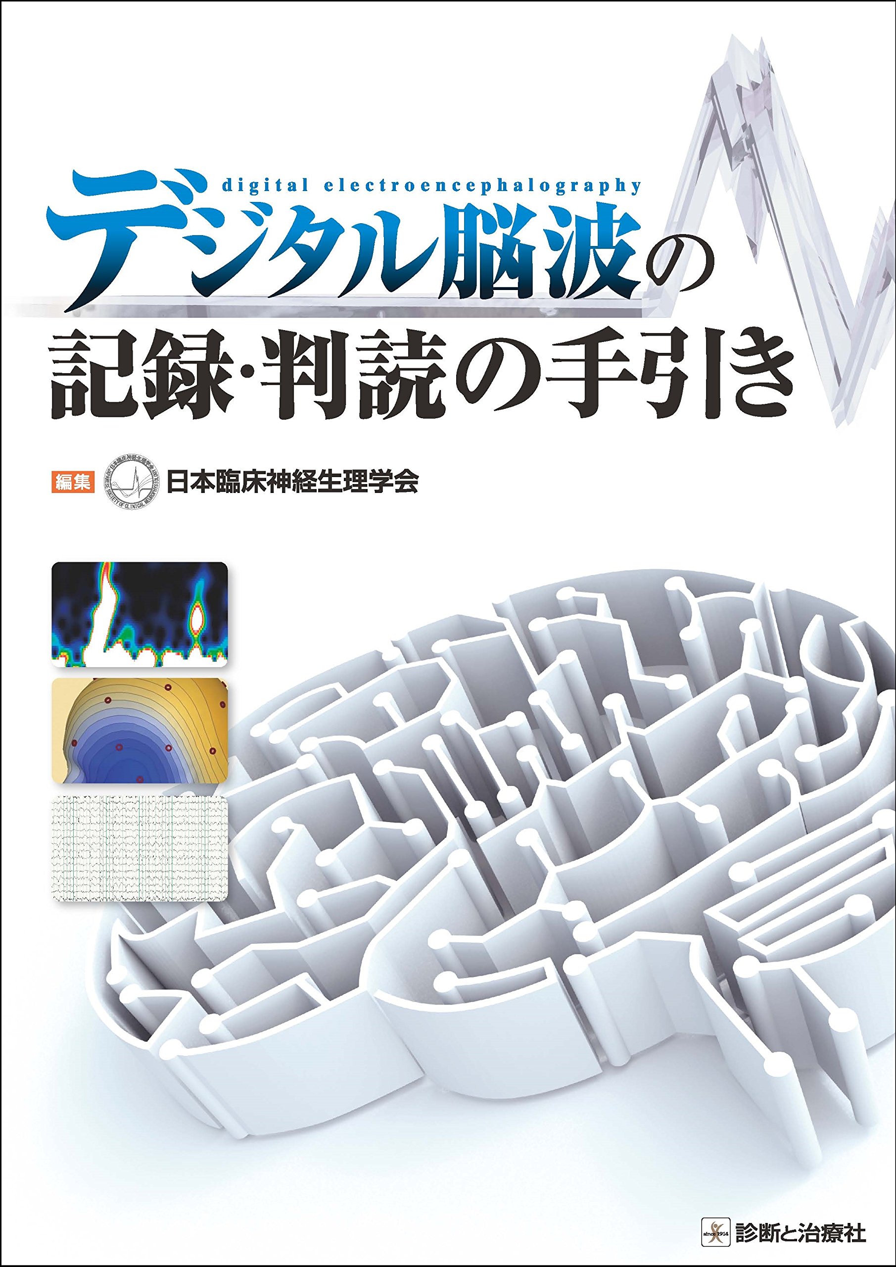 デジタル脳波の記録 判読の手引き 日本臨床神経生理学会 本 通販 Amazon