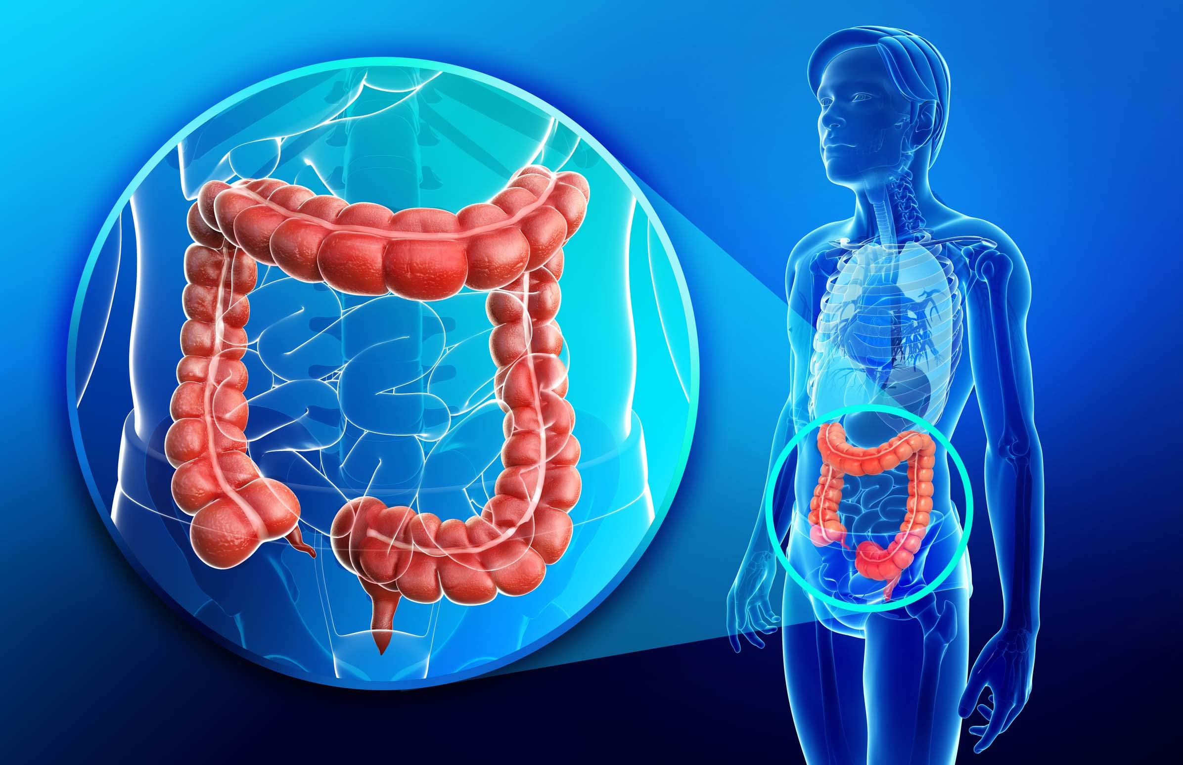 Crohn’s Disease Study IDs Variant That Could Personalize