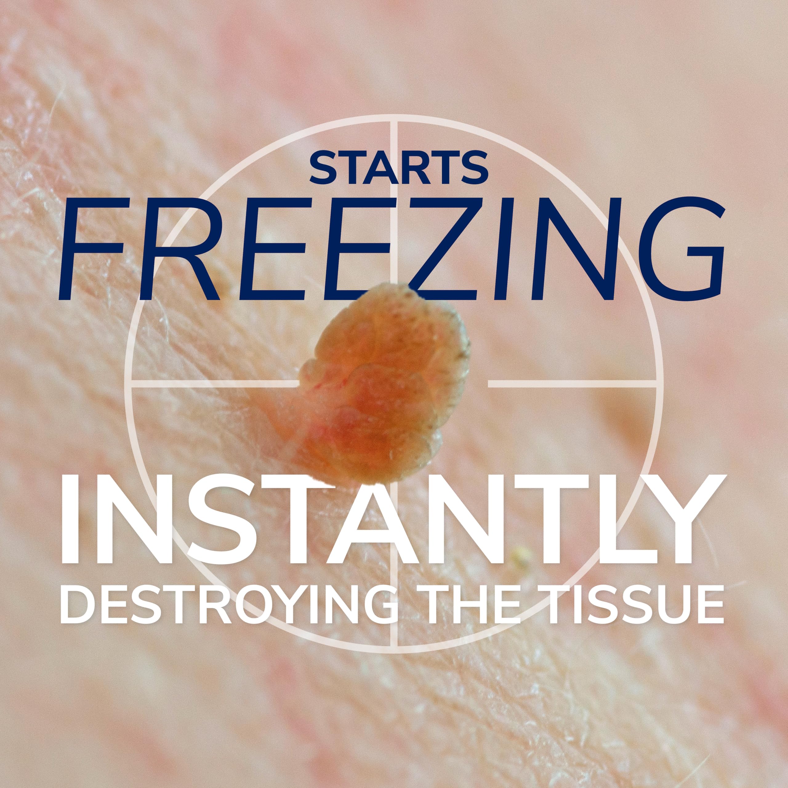 Dr. Scholl's Freeze Away Skin Tag Remover Kit, 8 ct – Completely removes Skin Tags in As Little As 1 Treatment, FDA-Cleared & Clinically Proven At-Home Removal, Easy 1-Handed Action, Permanent Results