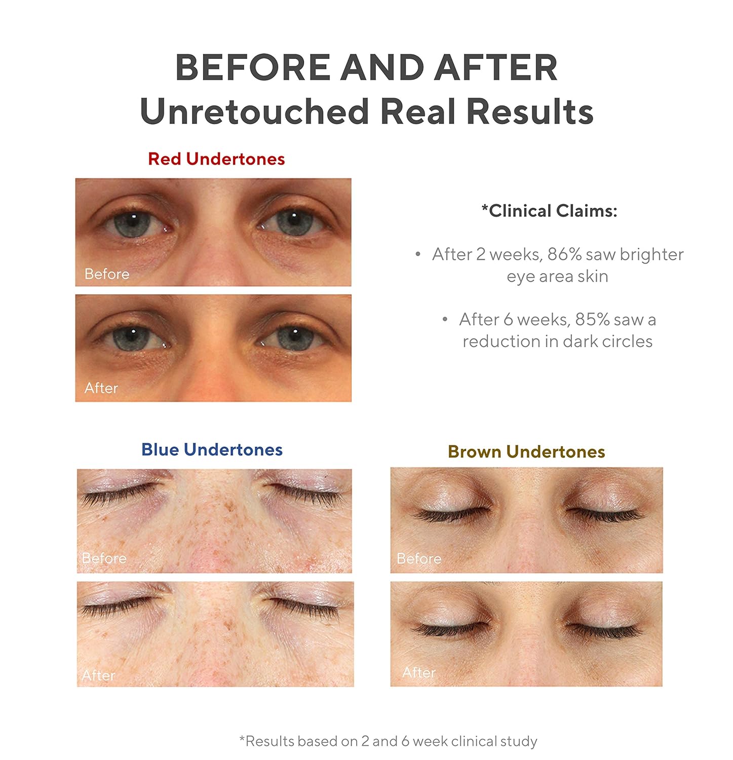 Amazon Com Murad Environmental Shield Vita C Eyes Dark Circle Corrector Dark Circle Eye Treatment Gold Stabilized Vitamin C Skin Care Eye Serum Anti Aging Under Eye Cream For Dark Circles 0 5