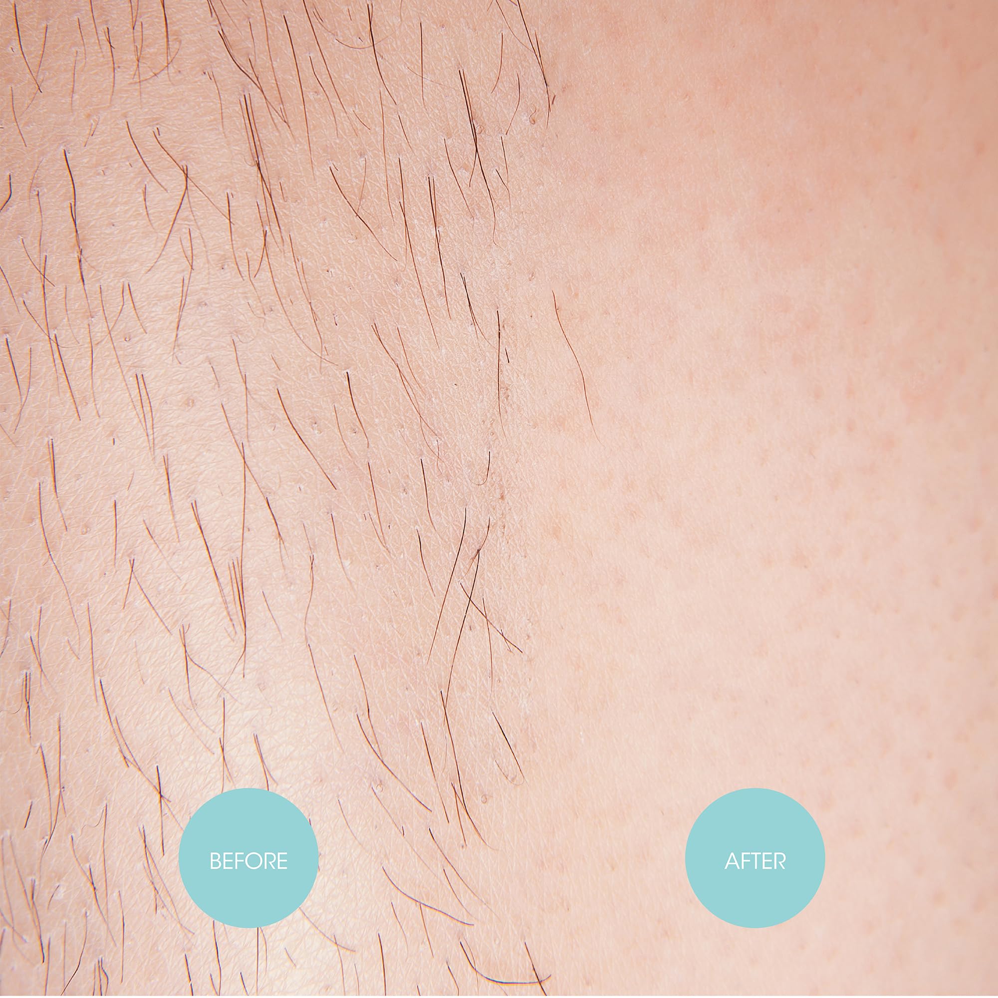 Nad's Extra Long Wax Strips - Hair Removal For Women - Waxing Kit with 20 Large Wax Strips + 4 Calming Oil Wipes