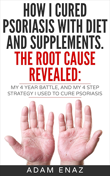 Healing Psoriasis The Natural Alternative Ebook John O A - 