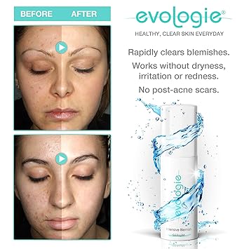 vightne blemish serum amazon