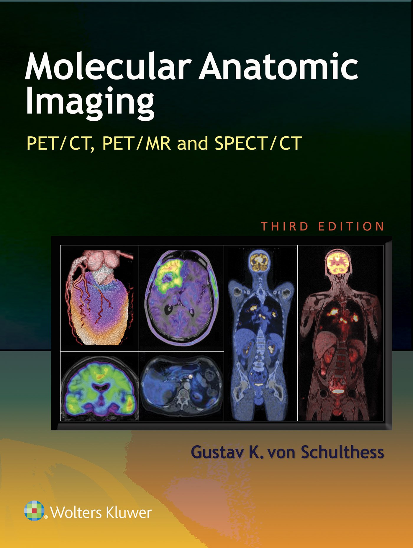 Molecular Anatomic Imaging Pet Ct Pet Mr And Spect Ct Kindle Edition By Von Schulthess Gustav K Professional Technical Kindle Ebooks Amazon Com